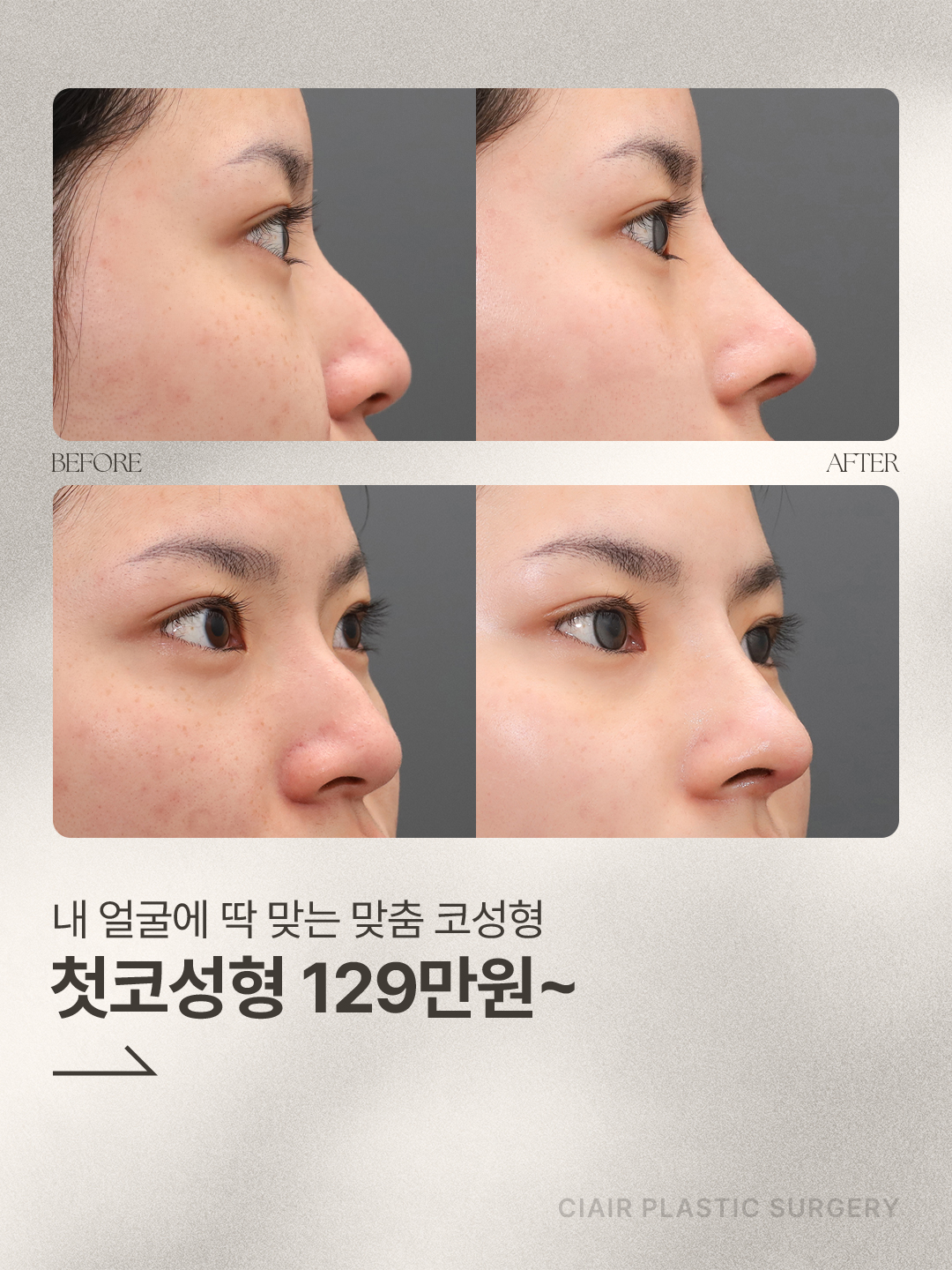 Before 7 Front