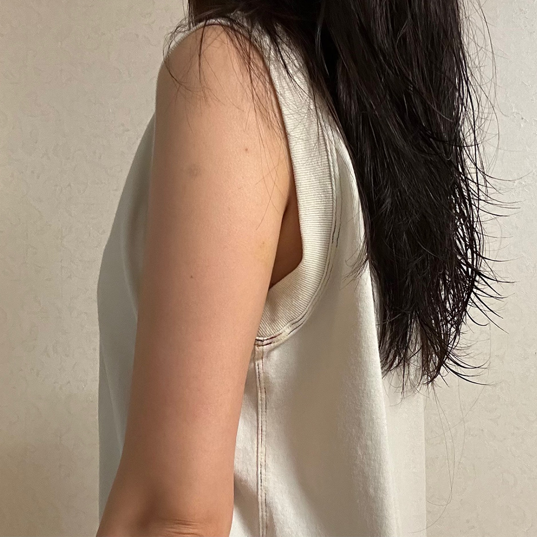 Before Image