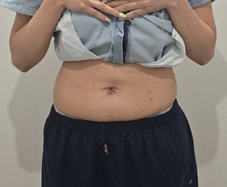Before Image