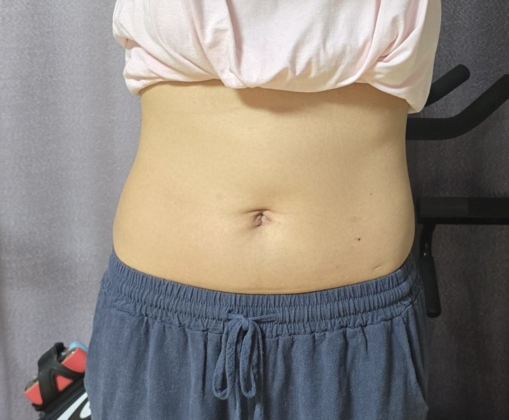 Before Image
